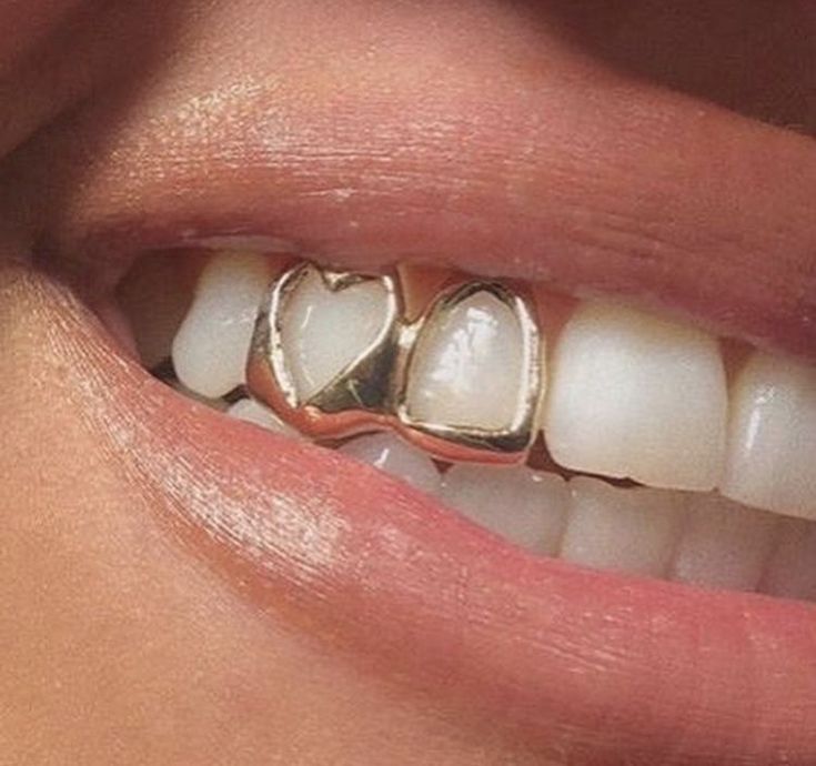 Heart-shaped double grillz