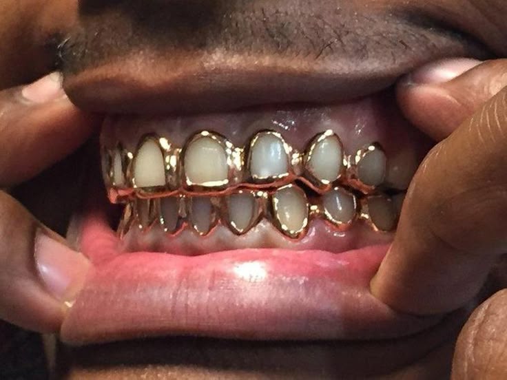 Upper + bottom teeth grillz (2pcs) GOLD