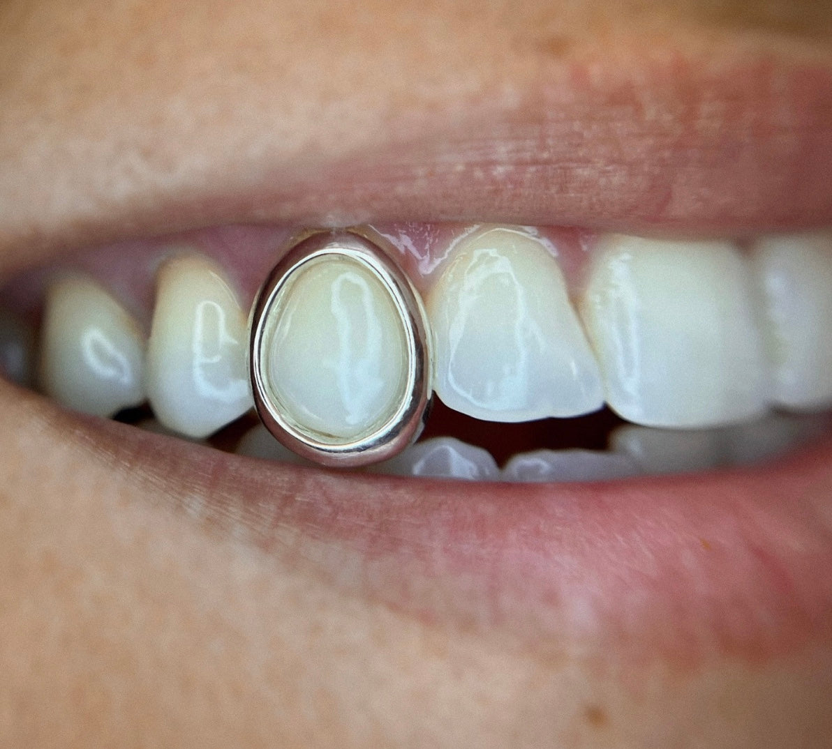 Silver cap grillz