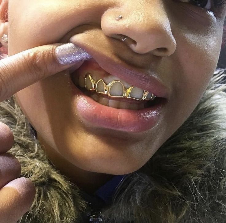 Grillz "upper teeth" gold