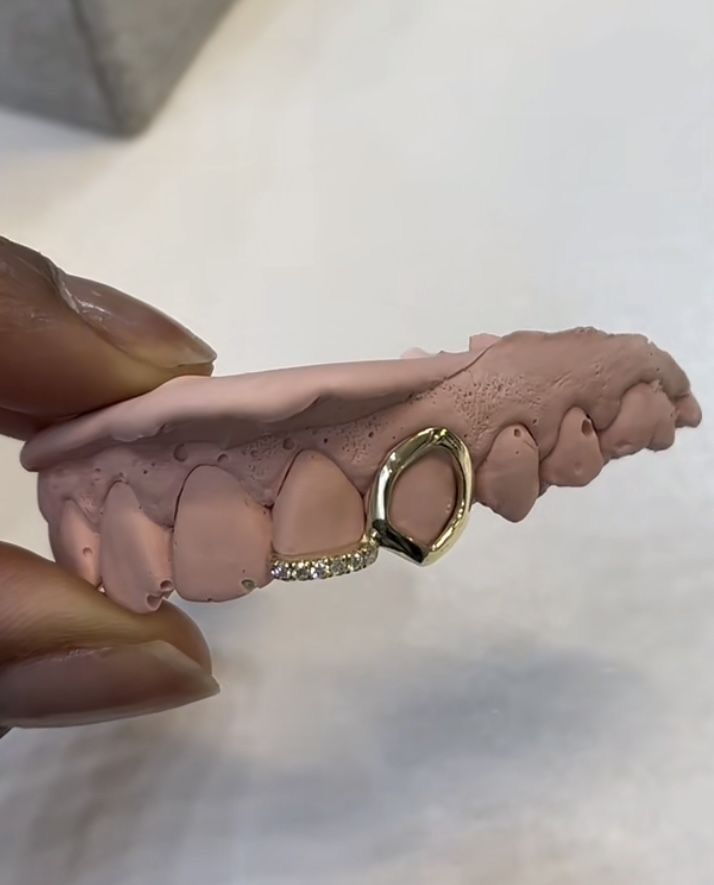 Teardrop-shaped grillz with a lower bar