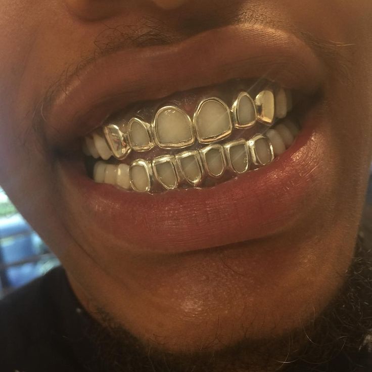 Upper + bottom teeth grillz (2pcs)