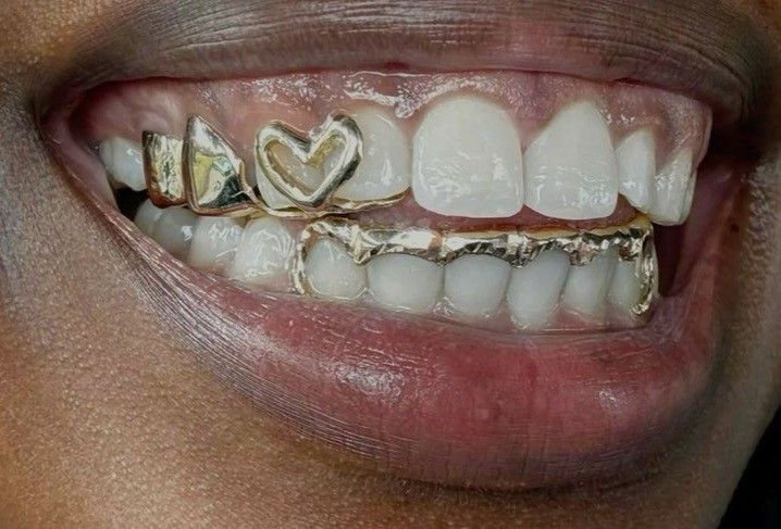 Heart grillz