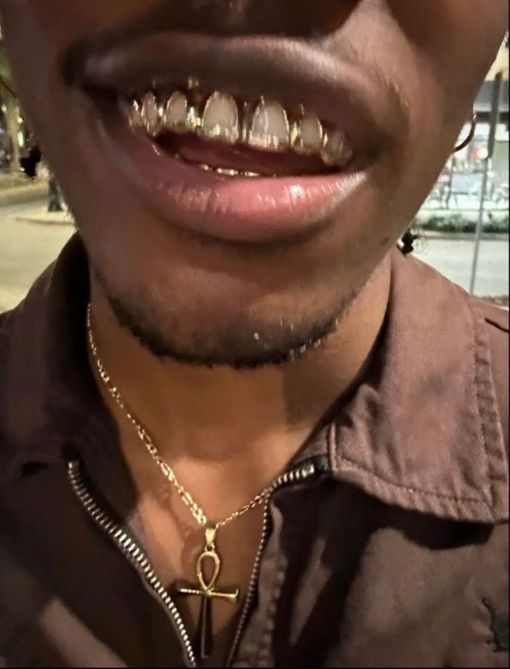 Grillz "upper teeth" gold