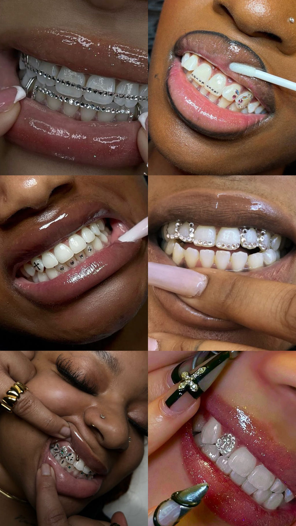 ICEESKIES Diy Tooth Gem Kit