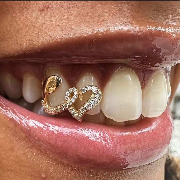 Heart-shaped grillz with gems